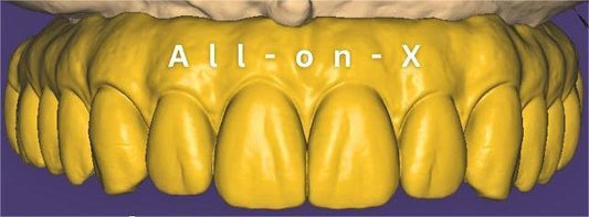 All on X design Same Day